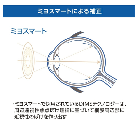 ミヨスマートによる補正